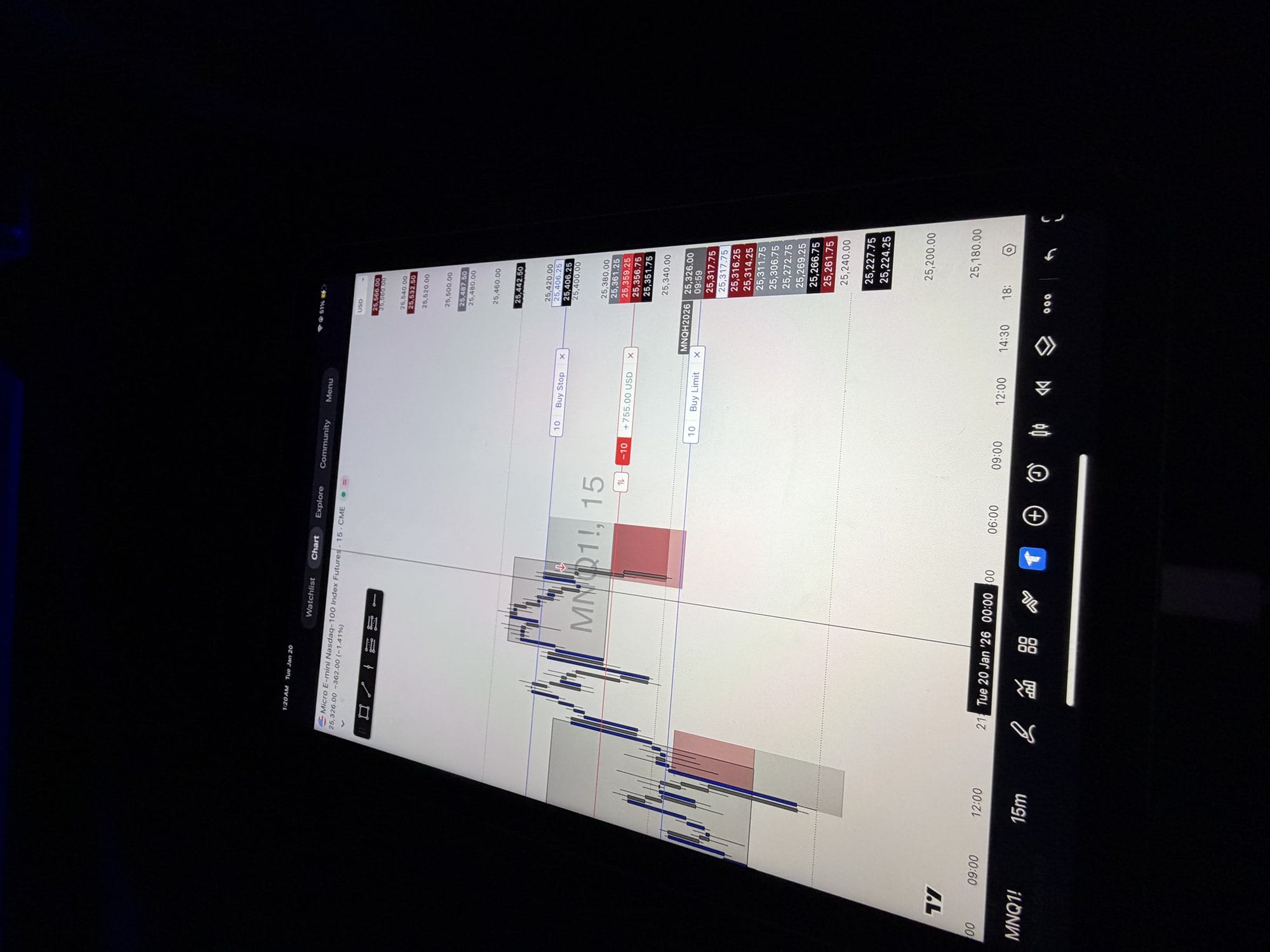 InstantTP — MNQ chart