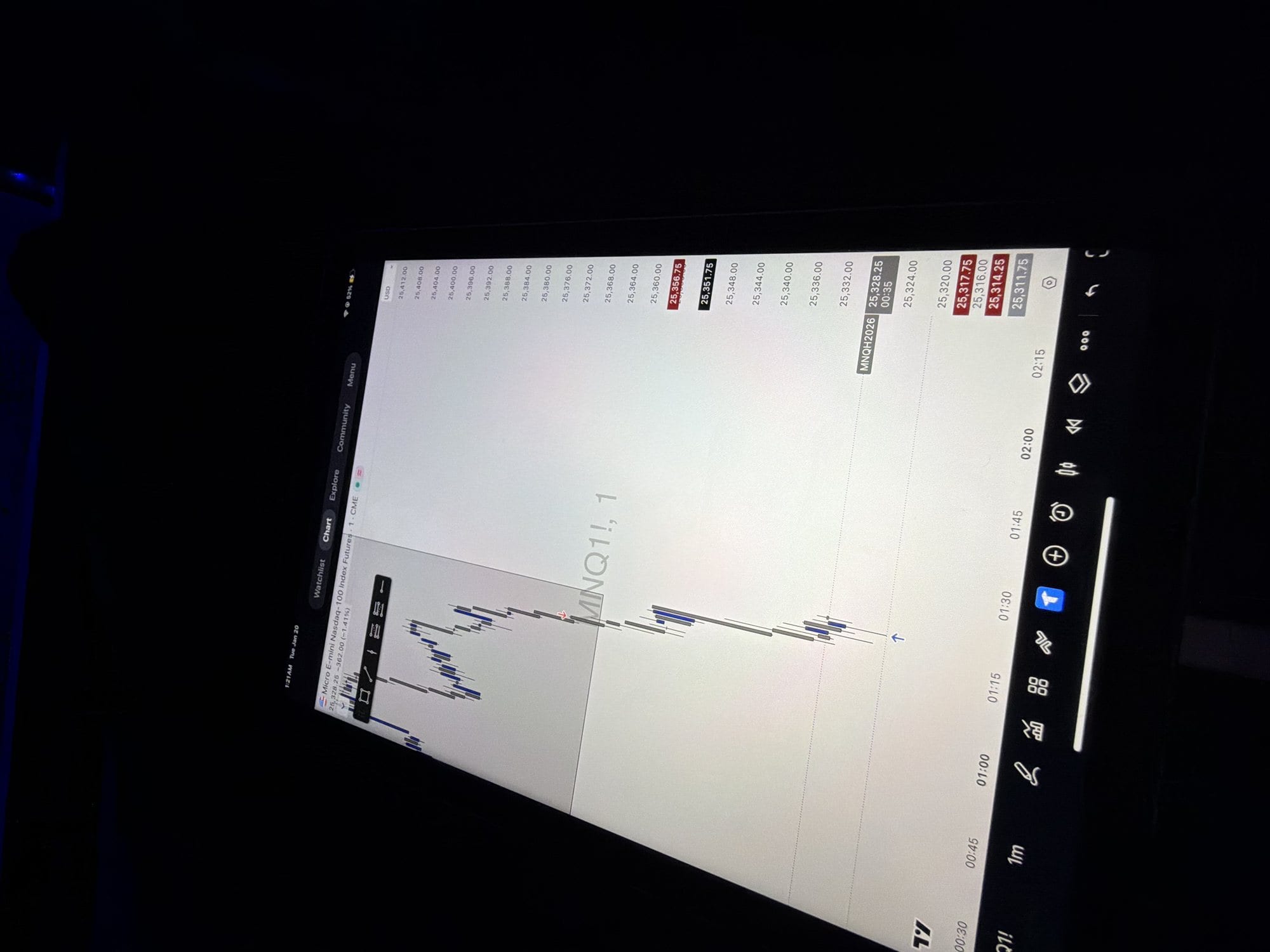 InstantTP — MNQ chart
